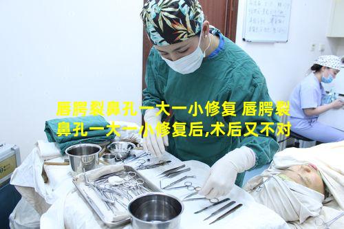 唇腭裂鼻孔一大一小修复 唇腭裂鼻孔一大一小修复后,术后又不对称